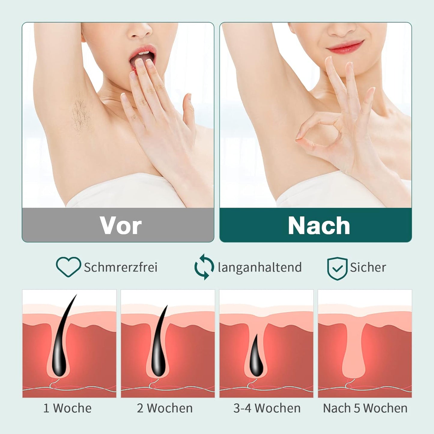 NICEBLE IPL Haarpflege mit Saphir-Eis-Kühlsystem, sorgenfreie Haarpflege für Frauen und Männer, Verbessern Sie die Haarpflege für Ihr Zuhause mit Körper- und Gesichtsmodus