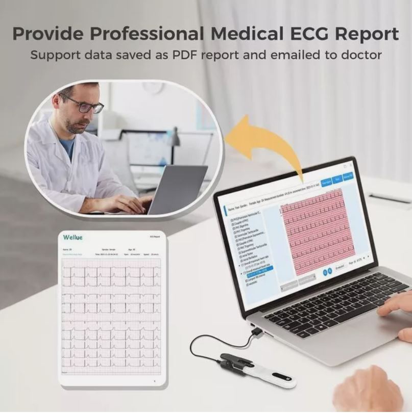 Wellue ER1-LW | 24 Stunden Langzeit EKG Gerät | Analyse über PC und App