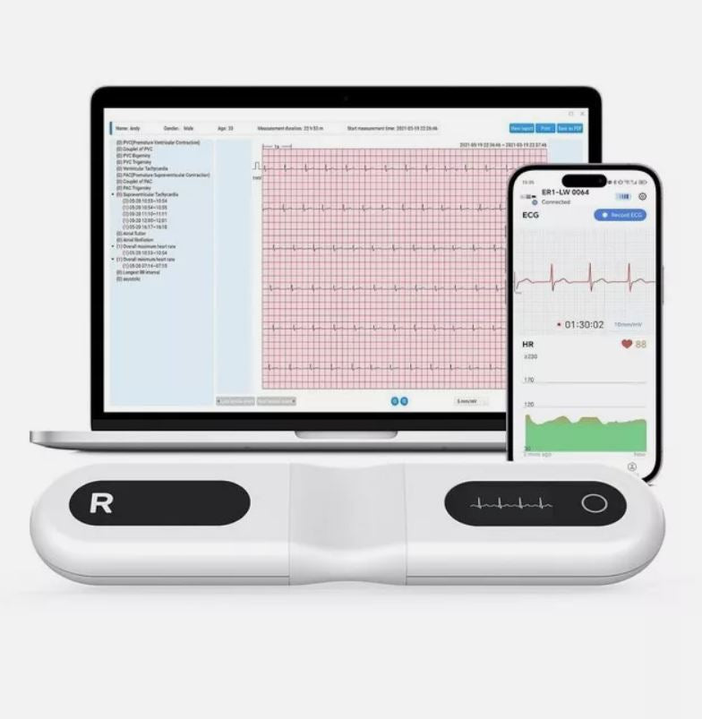 Wellue ER1-LW | 24 Stunden Langzeit EKG Gerät | Analyse über PC und App