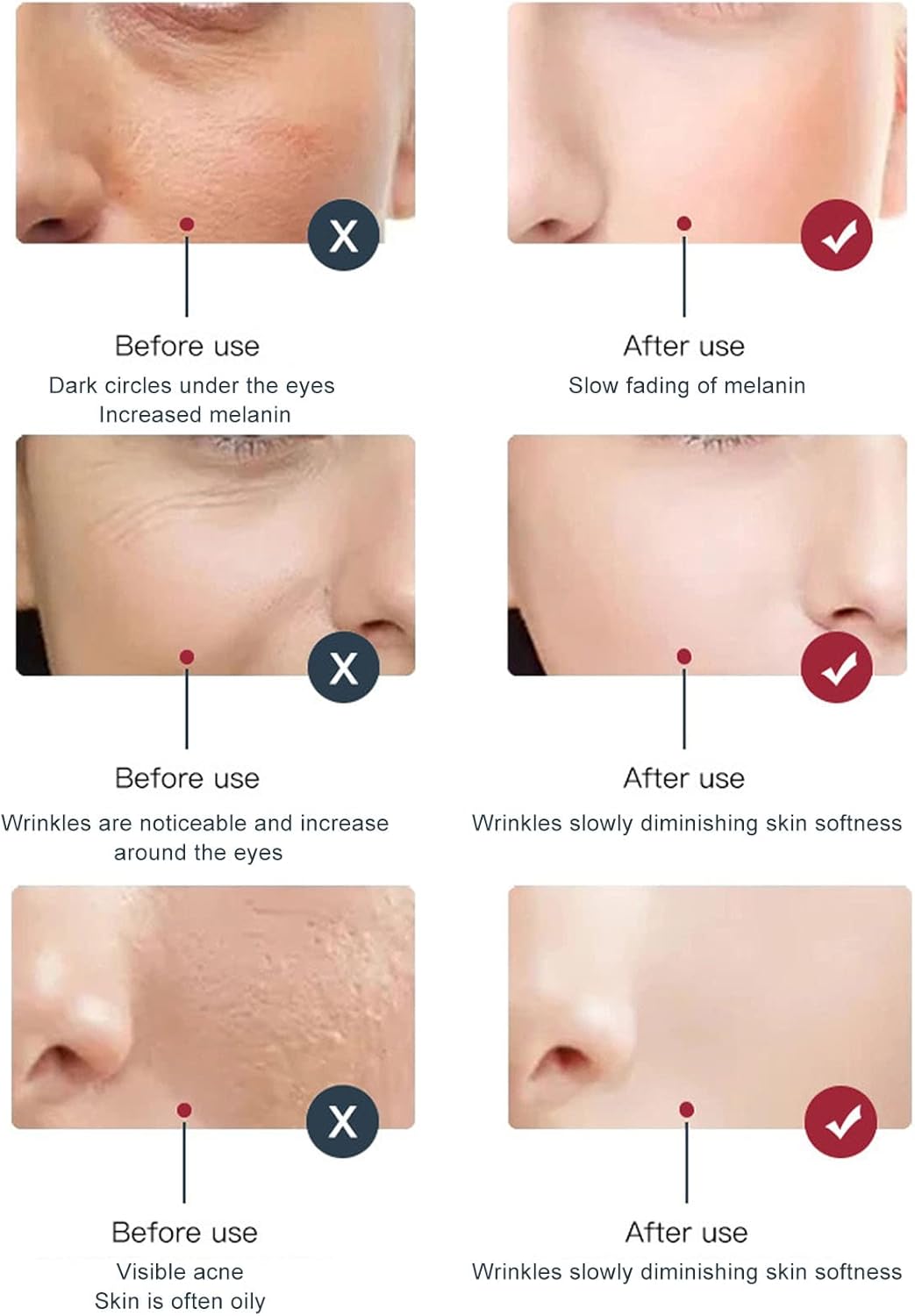 Gerät de photothérapie LED à 6 facteurs, Gesichtshautpflege-Lichtgerät mit Spray, Faltbares Phototherapiegerät pour salons de coiffure, 100 V-240 V