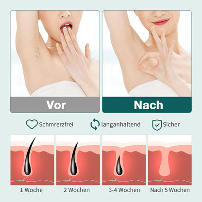 NICEBLE IPL Haarpflege mit Saphir-Eis-Kühlsystem, sorgenfreie Haarpflege für Frauen und Männer, Verbessern Sie die Haarpflege für Ihr Zuhause mit Körper- und Gesichtsmodus