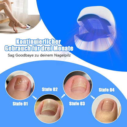 Nagelpilz Laser gerät Laser Nagelpilz Schnell Wirkende Hocheffizientes Nagelpilz Kaltlasertherapie, Behandlung von mehreren Zehen und bequemen Füßen 4 Blau 2 Infrarot Therapie Nagelpilz Laser (a)