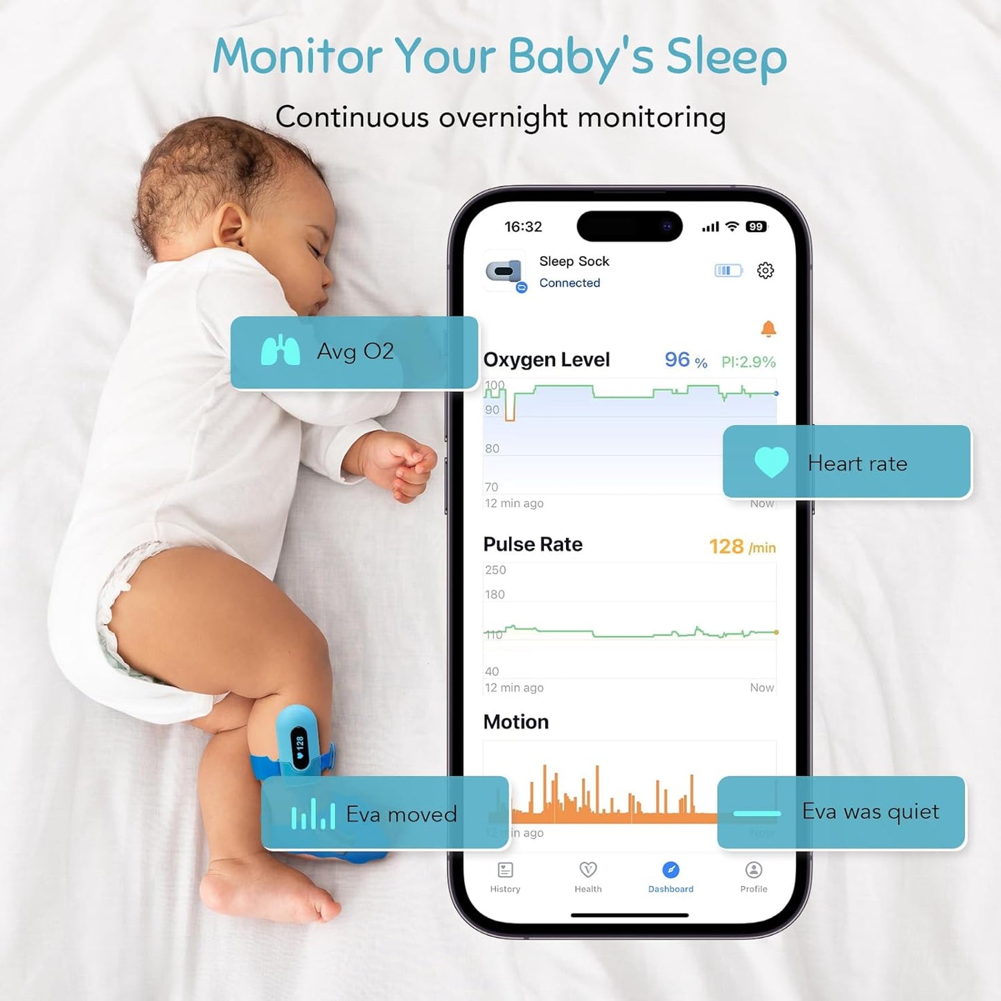 Babytone BabyO2 S2 Pulsoximeter  Schlafmonitor mit Echtzeit-Basisstation für 0-3 Jahre