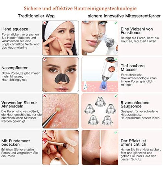 Bestope Mitesser Entferner Staubsauger - Mitesser entfernen - Porenreiniger