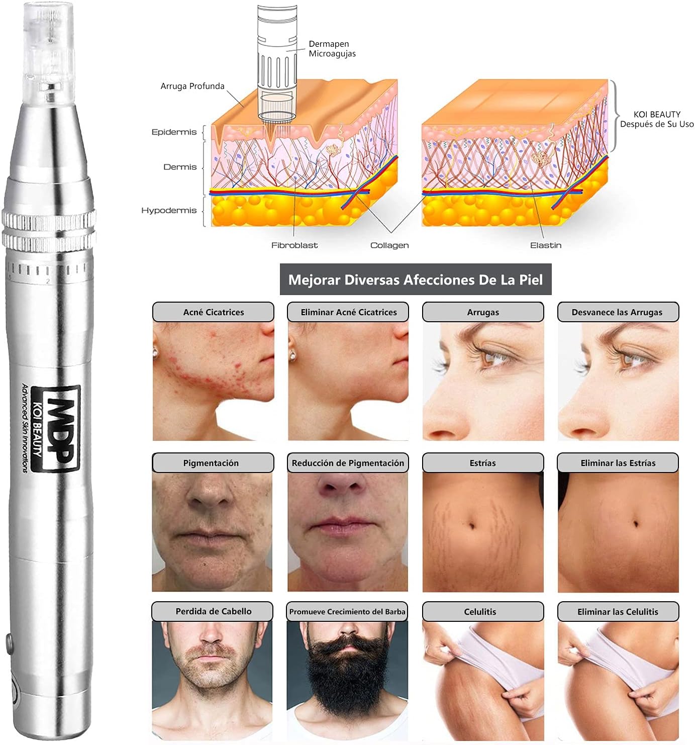 Koi Beauty Elektrischer Derma-Pen,  Microneedling Pen, professioneller Stift, 0,25–2,5 mm