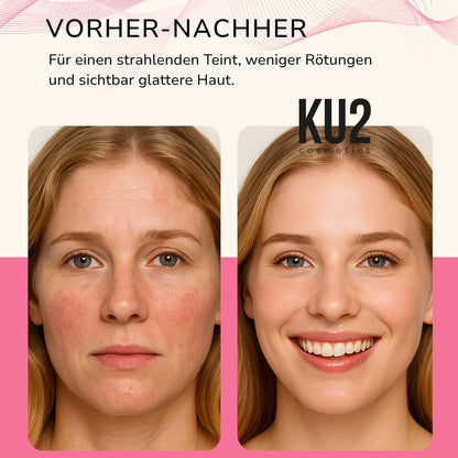KU2 LED Gesichtsmaske mit 7 Lichtmodi  180 LEDs für Anti Aging