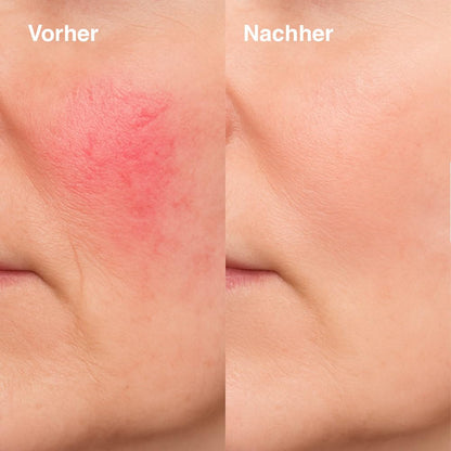 KU2 LED Gesichtsmaske mit 7 Lichtmodi  180 LEDs für Anti Aging