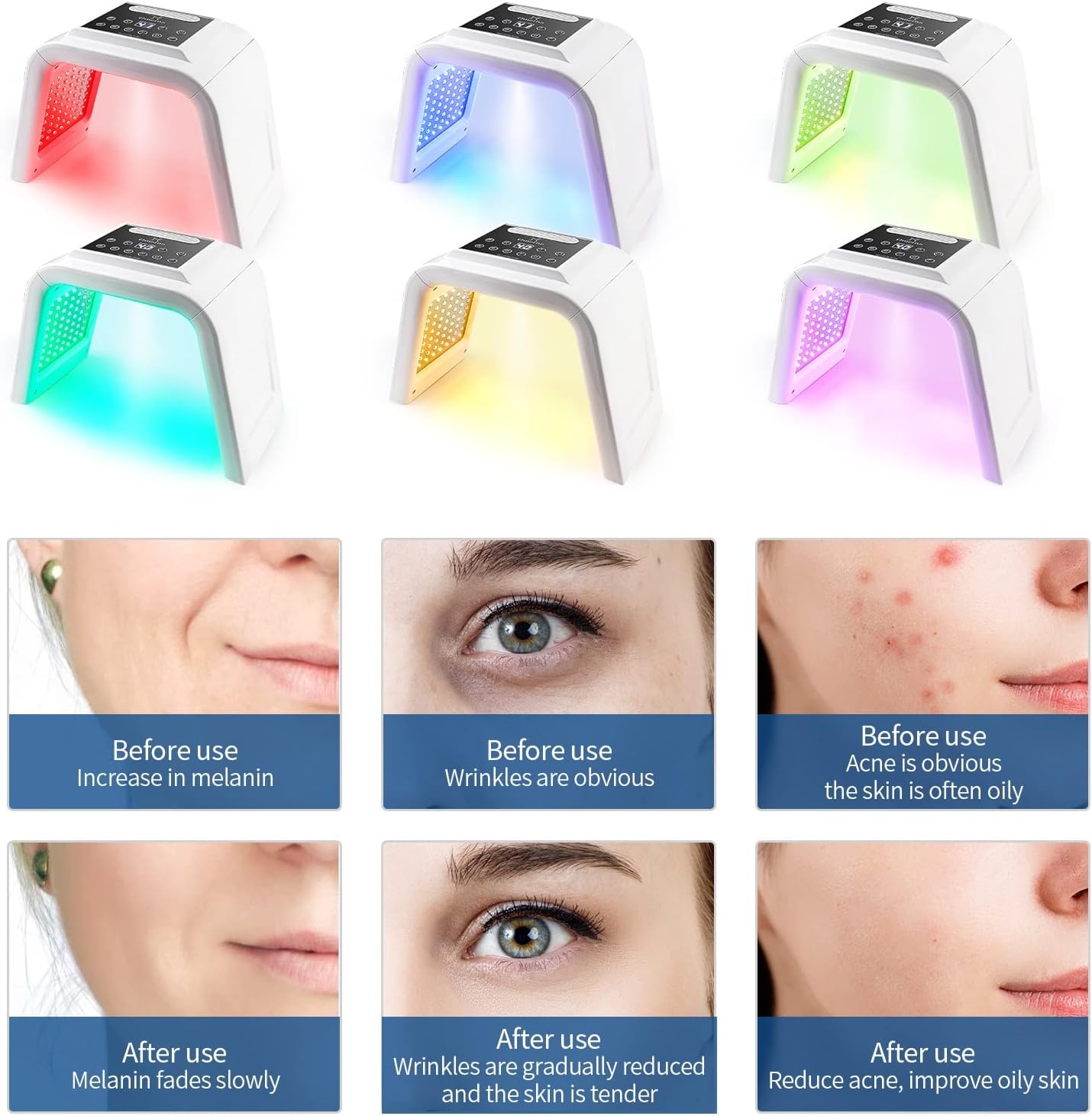 OMENIA 7-Farben-LED-Licht-Gesichtsmaske gegen Mitesser, Schönheit