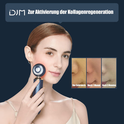RF Radiofrequenz Gerät, DJM 4.0 Home 4.0MHz Mikrostrom Gesichtspflegeinstrument Anti-Aging Gerät mit Kollagenregeneration Faltenreduktion
