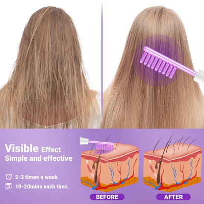 UUPAS Hochfrequenz Gesichtsmaschine, Gesichtsstab, Tragbarer mit 4 violetten Röhren